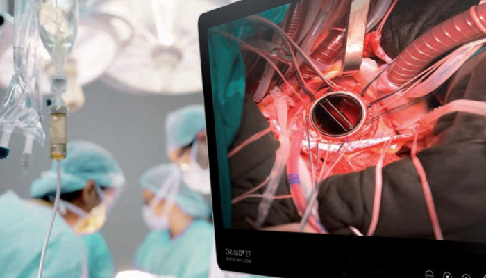 Medical grade computers